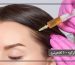 هیر فیلر Hair Filler در ترکیه-min