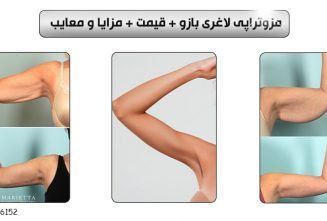 مزوتراپی لاغری بازو + قیمت + مزایا و معایب ✔-min